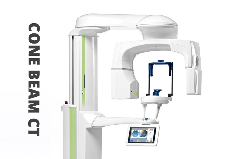 Cone Beam CT Imaging in San Fernando
