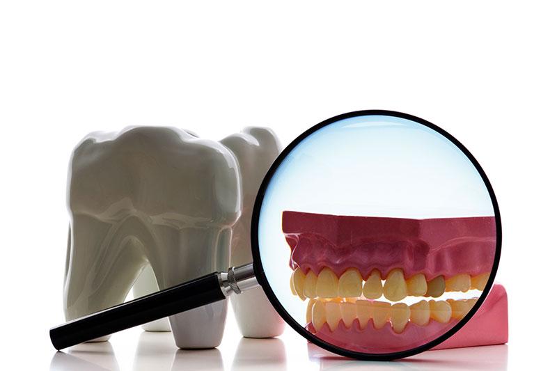 Root Canal Treatment in South Gate & San Fernando