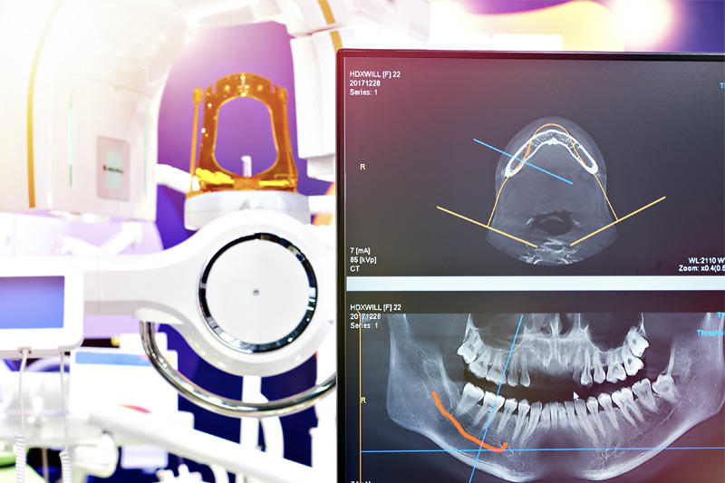 Digital X-Rays in San Fernando